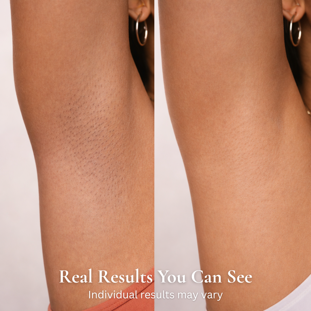 Hair Reduction Oil