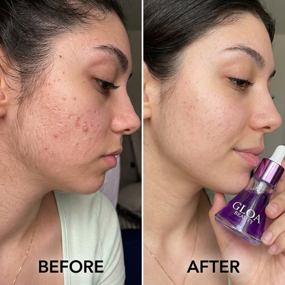Hair Reduction Oil 2