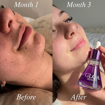 Hair Reduction Oil 2
