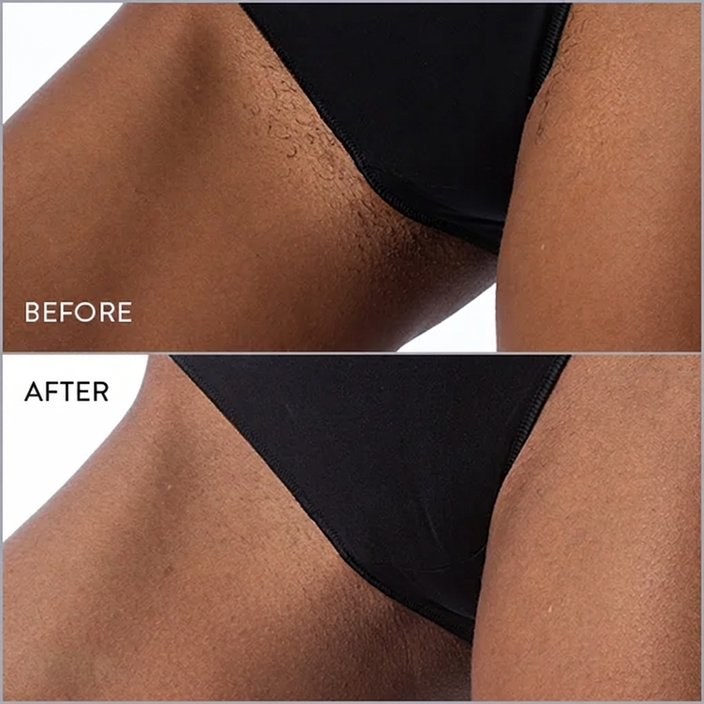 Hair Reduction Oil 2