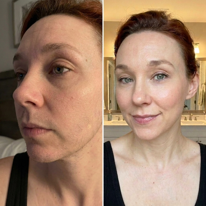 Hair Reduction Oil